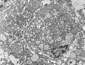 normal seromucinous salivary gland normal seromucinous salivary gland